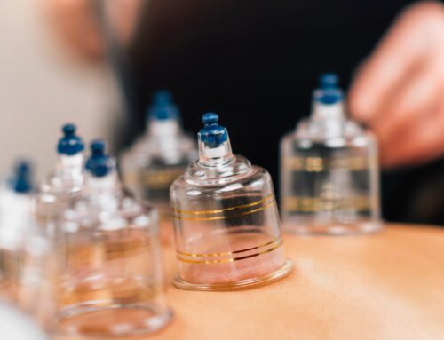 The Science Behind Cupping: Ancient Wisdom Meets Modern Wellness